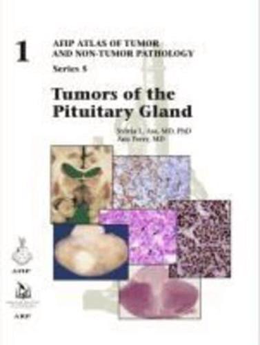 Tumors of the Pituitary Gland - AFIP Atlas of Tumor and Non-Tumour Pathology. Fifth Series                                                            <br><span class="capt-avtor"> By:(U.S.), Armed Forces Institute of Pathology       </span><br><span class="capt-pari"> Eur:130,07 Мкд:7999</span>